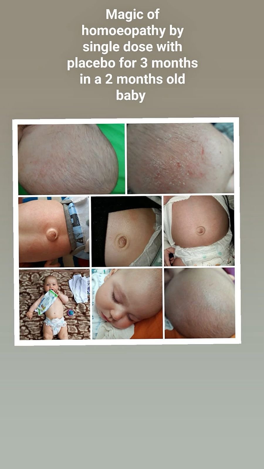 Before Treatment