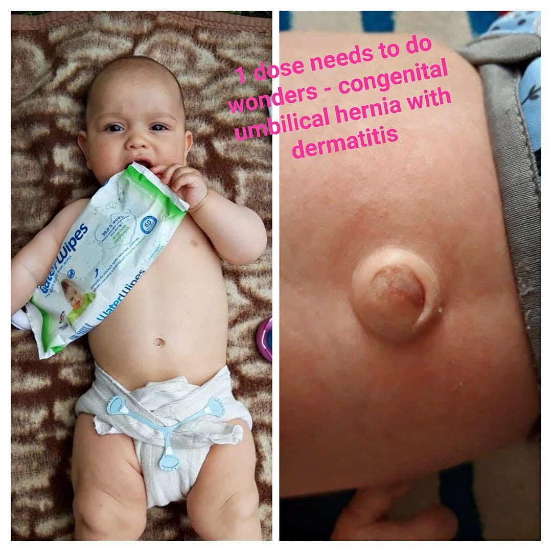 Before Treatment