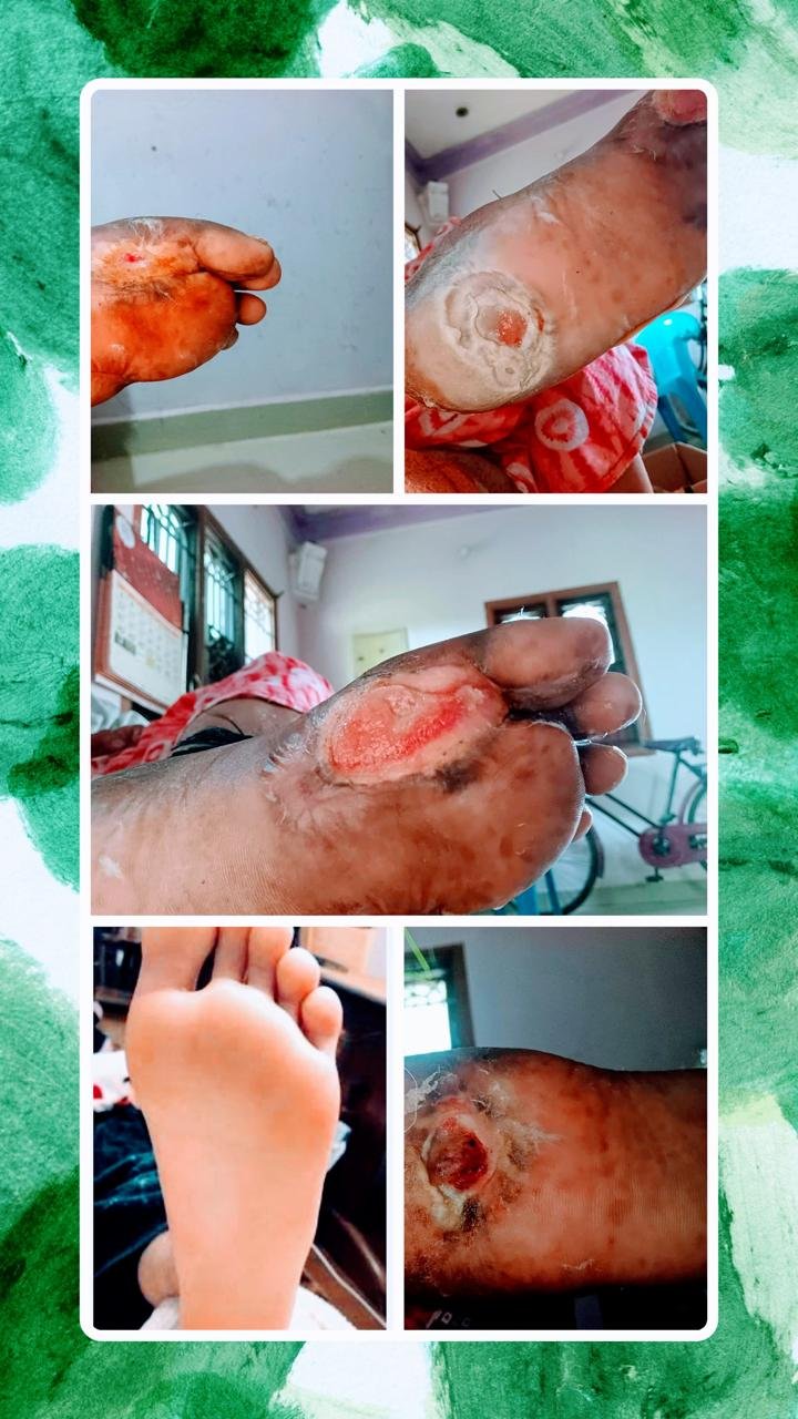 Before & After Treatment