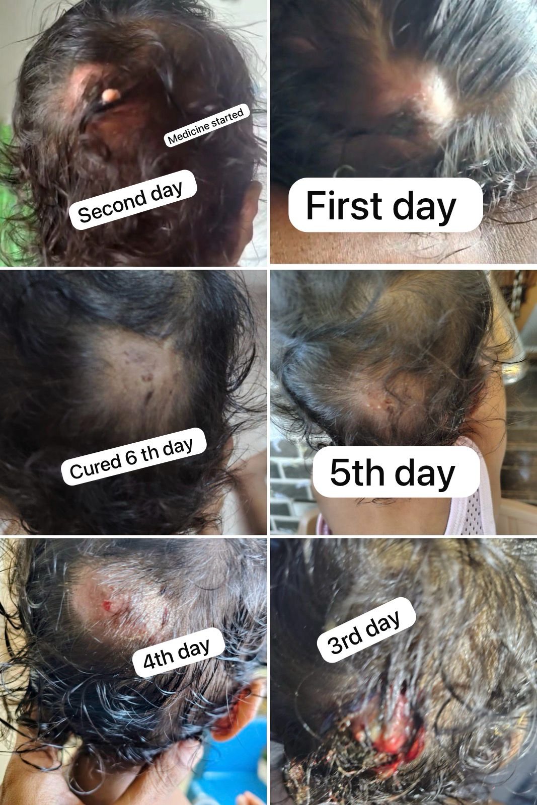 Before & After Treatment
