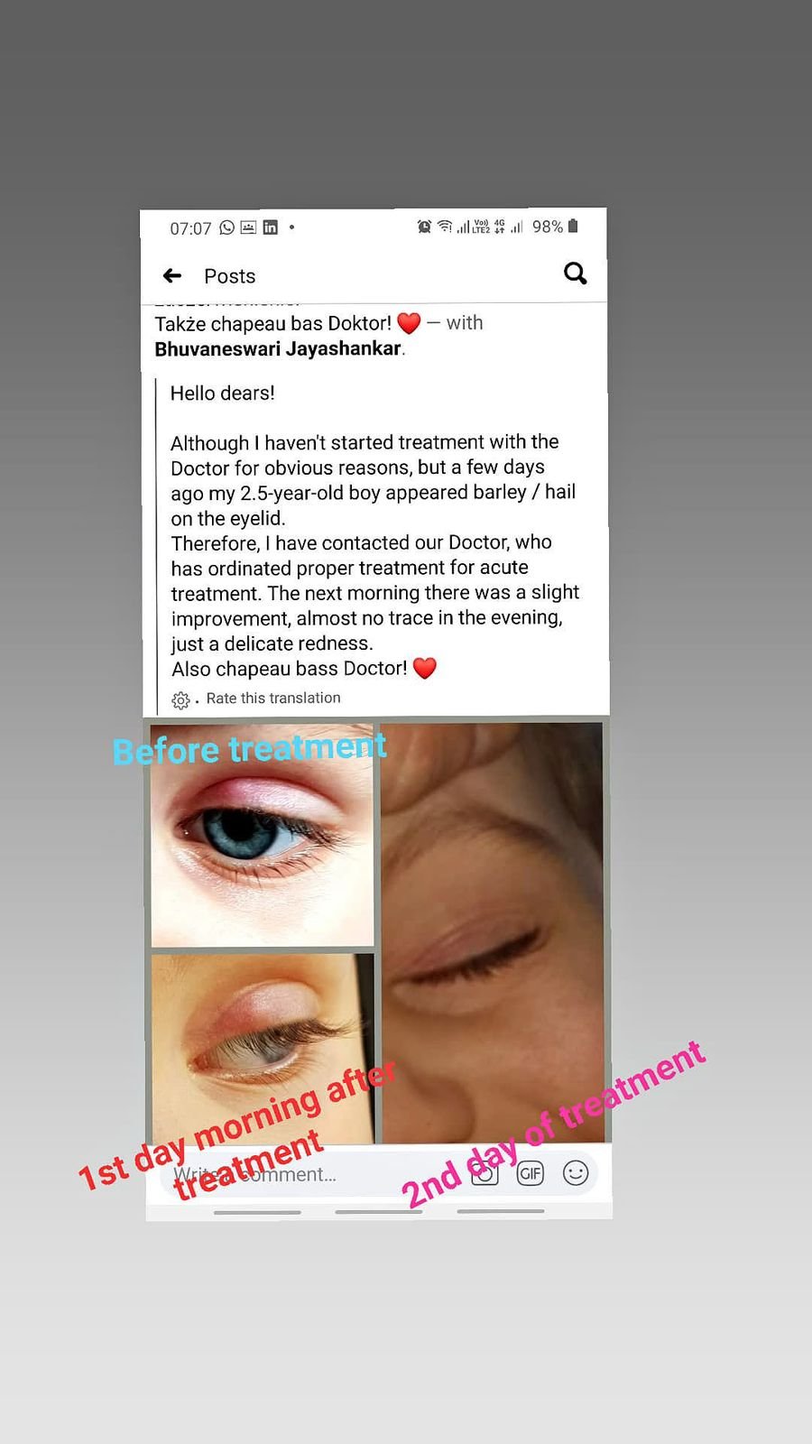 Before & After Treatment