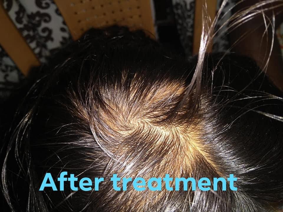 After Treatment