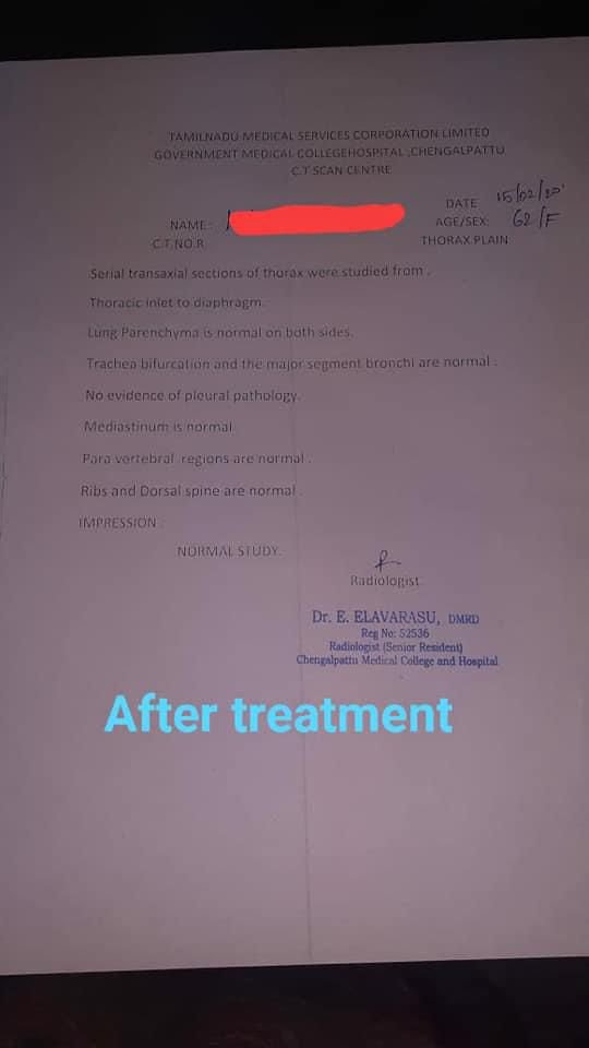 After Treatment