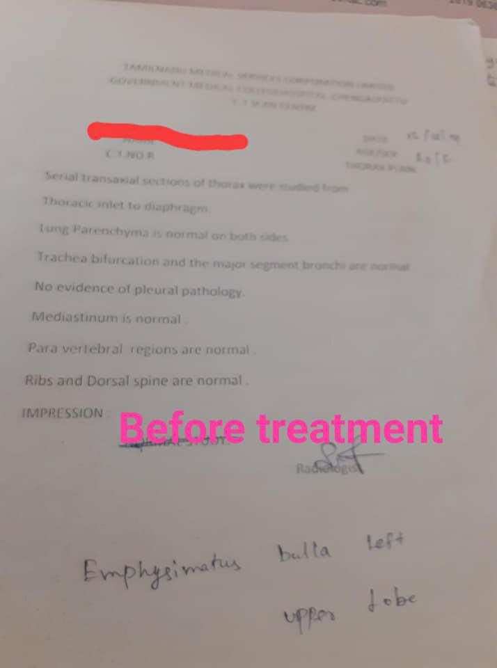 Before Treatment