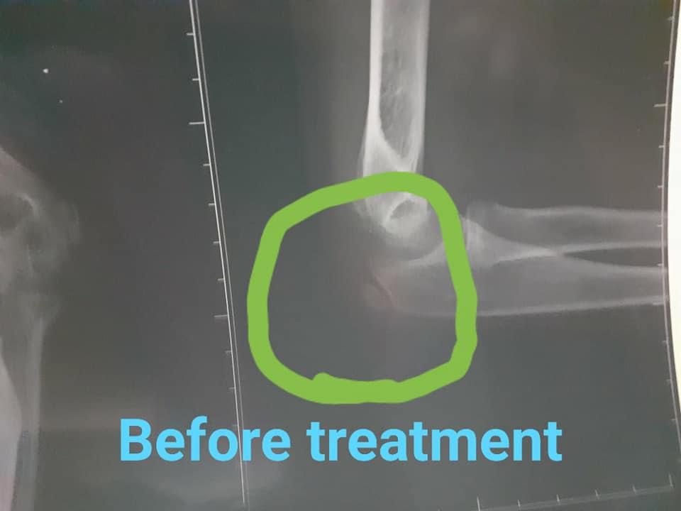 Before Treatment