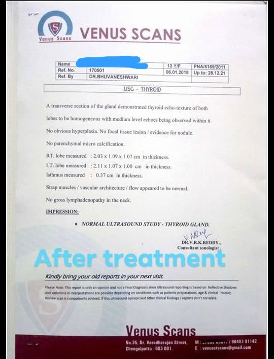 After Treatment