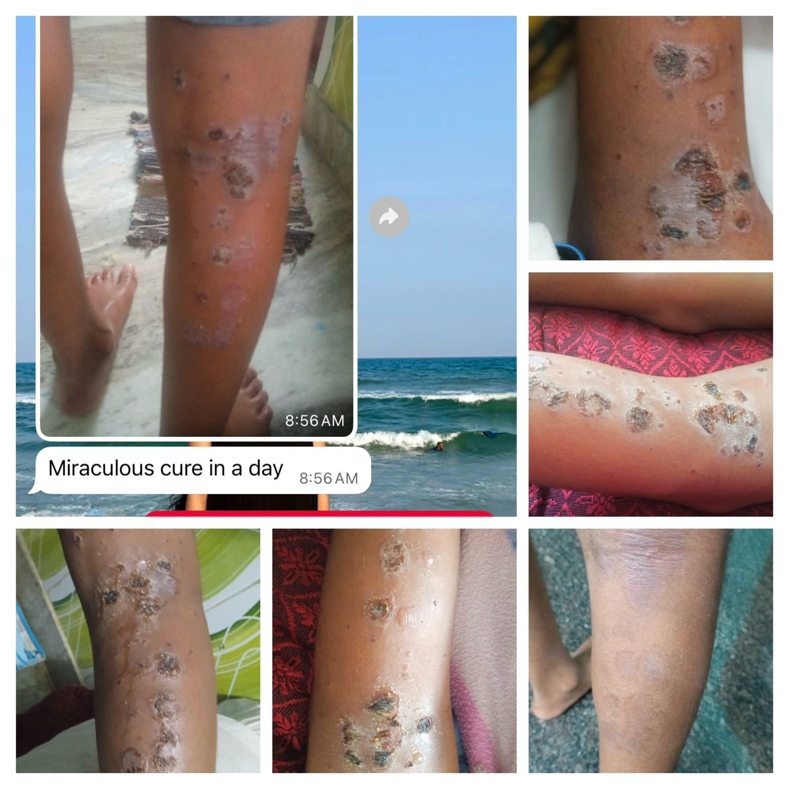 Before & After Treatment