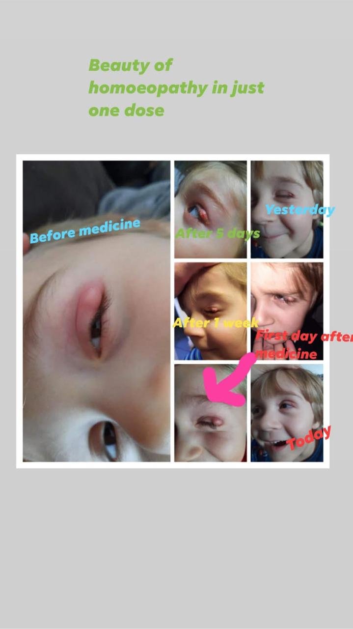 Before & After Treatment