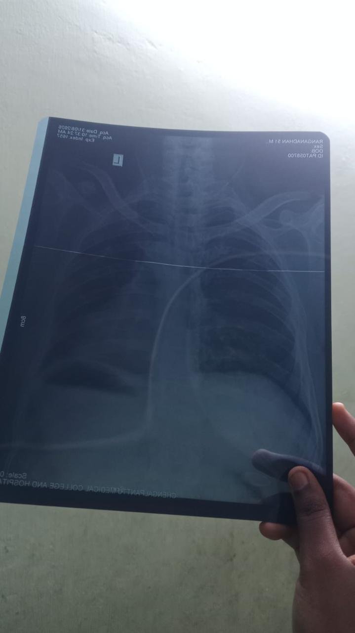 xray