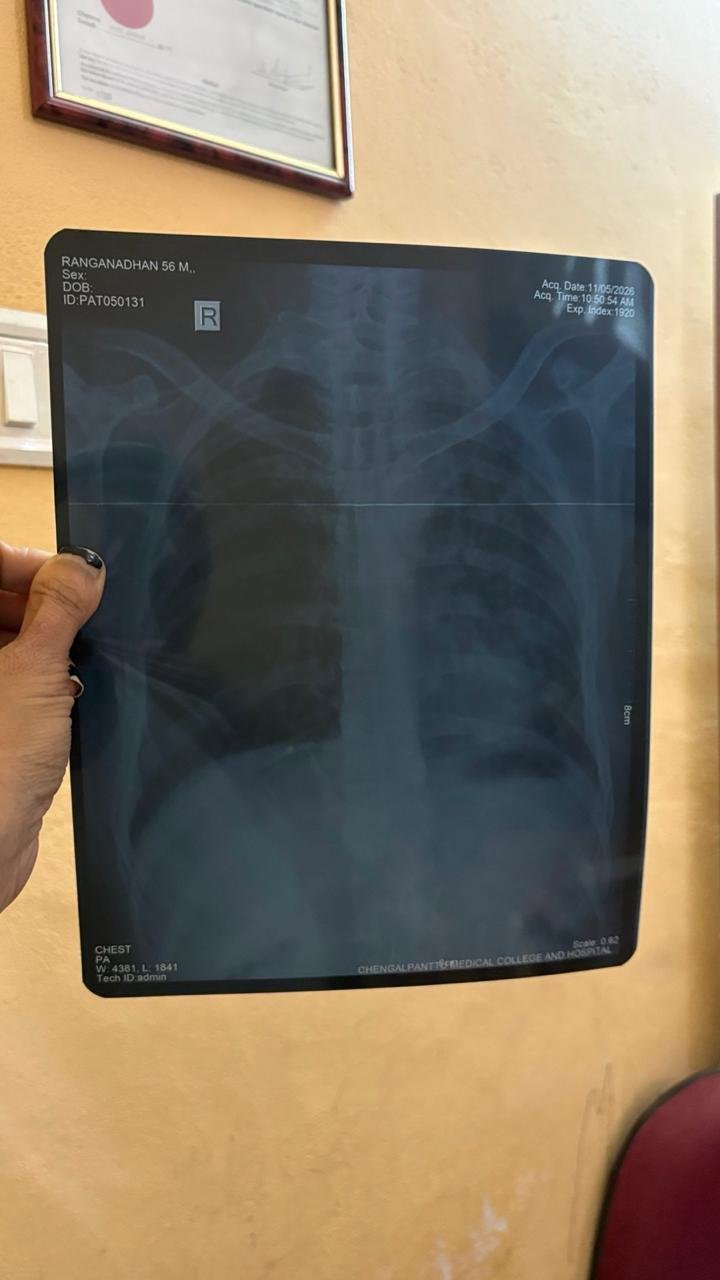 x-ray